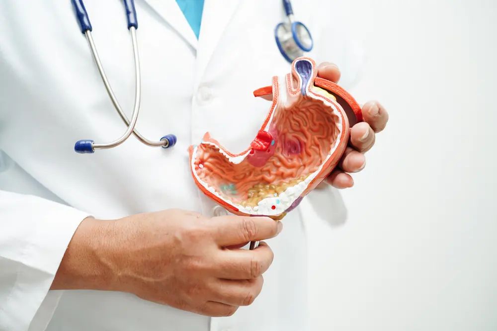 Hérnia Umbilical e Epigástrica: Quando a Cirurgia é Necessária e a Recuperação Minimamente Invasiva